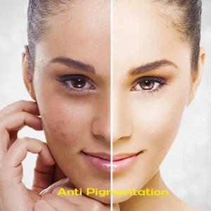 anti-pigmentation img