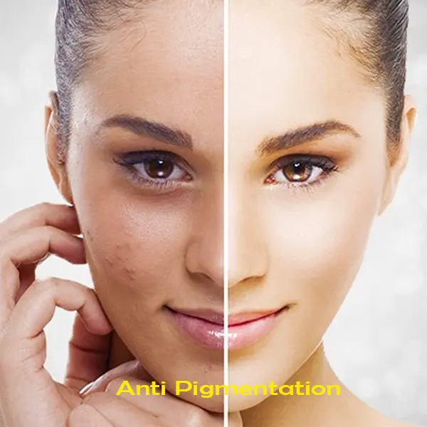 anti-pigmentation img