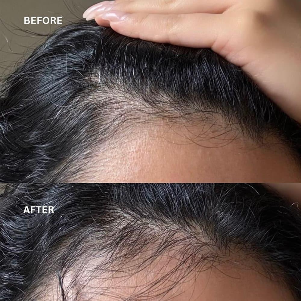 Hair Growth Oil for Hair Fall Control before and after